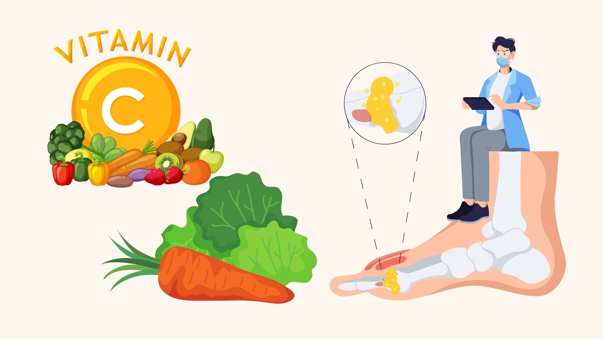 El secreto para reducir el acido urico en el hogar no necesita medicina. Grafico: Linh Dan