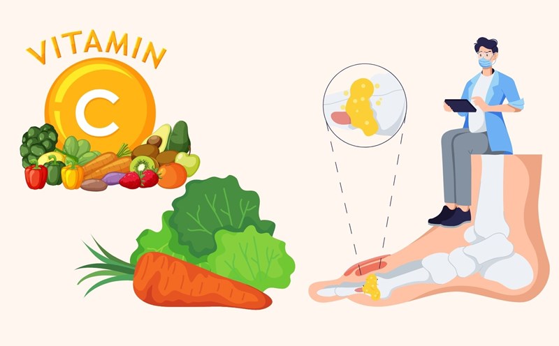 The secret to lowering uric acid at home without medicine. Graphics: Linh Dan