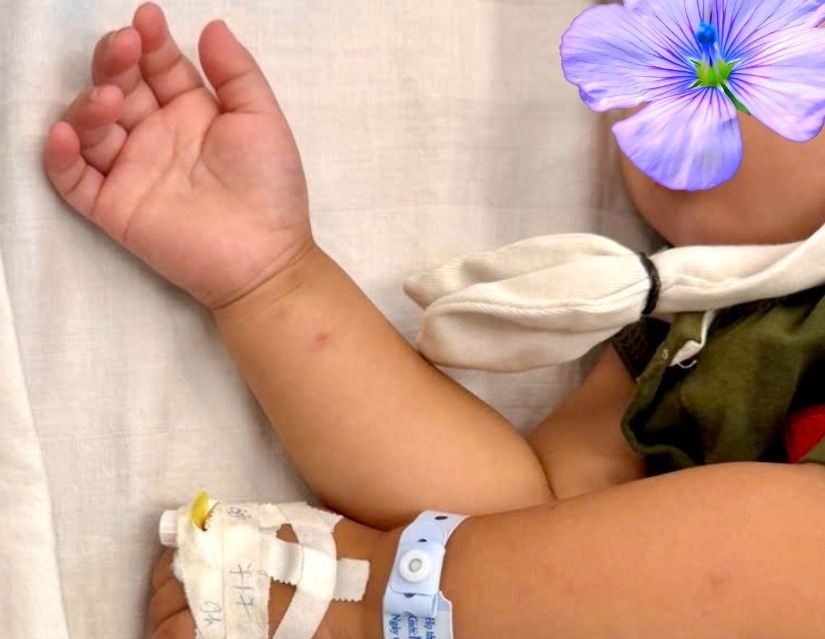 The 26-month-old baby who accidentally took antifungal has recovered his health. Photo: BVCC