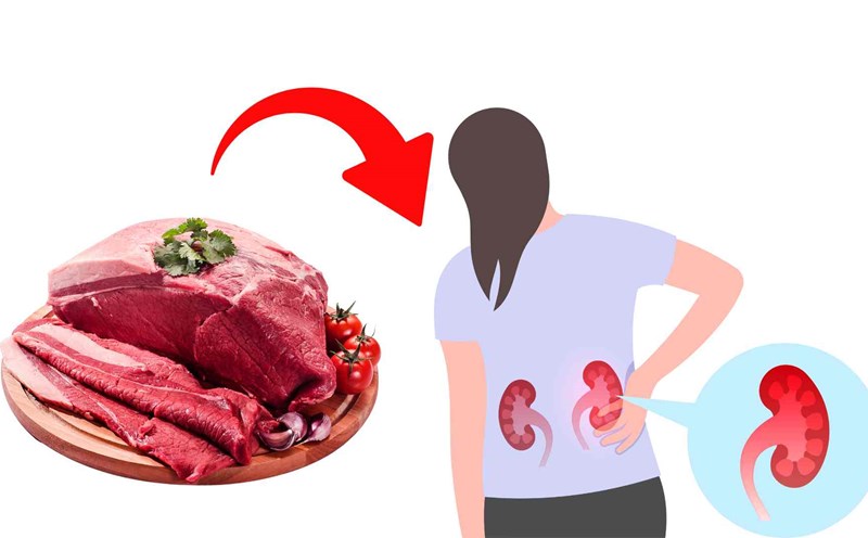 Eating too much red meat will harm the kidneys. Graphics: Ha May