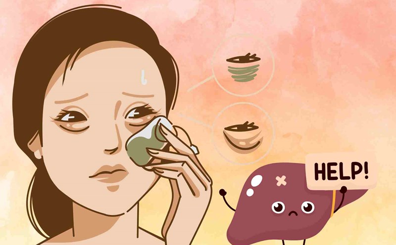 3 unusual signs on the face that show that the liver is having problems