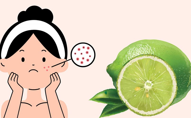 Lemon helps treat tan effectively. Graphic photo: Hoang Loc
