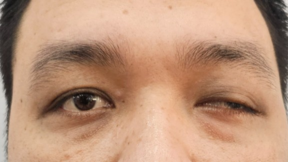 Anh: Dong Y Son Ha