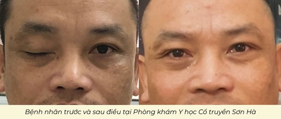 Anh: Dong Y Son Ha