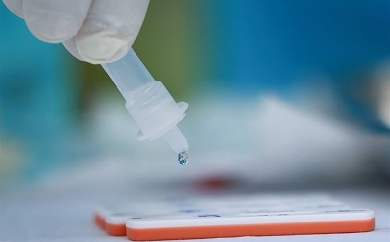 Hanoi recorded the first case of Japanese encephalitis of the year, the number of COVID-19 cases doubled. Photo: Hai Nguyen