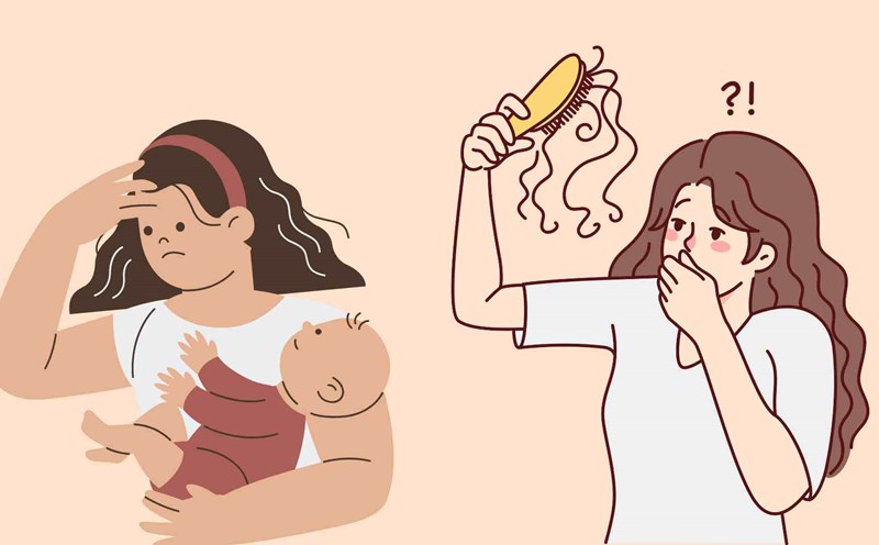 Postpartum women often experience hair loss. Graphic photo: Hoang Loc