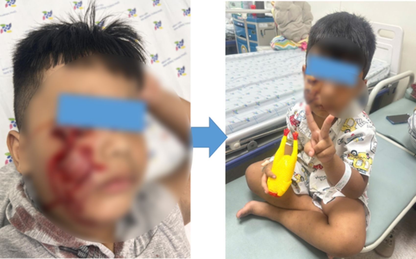 The patient's right face was torn by a dog. Photo: Provided by the hospital