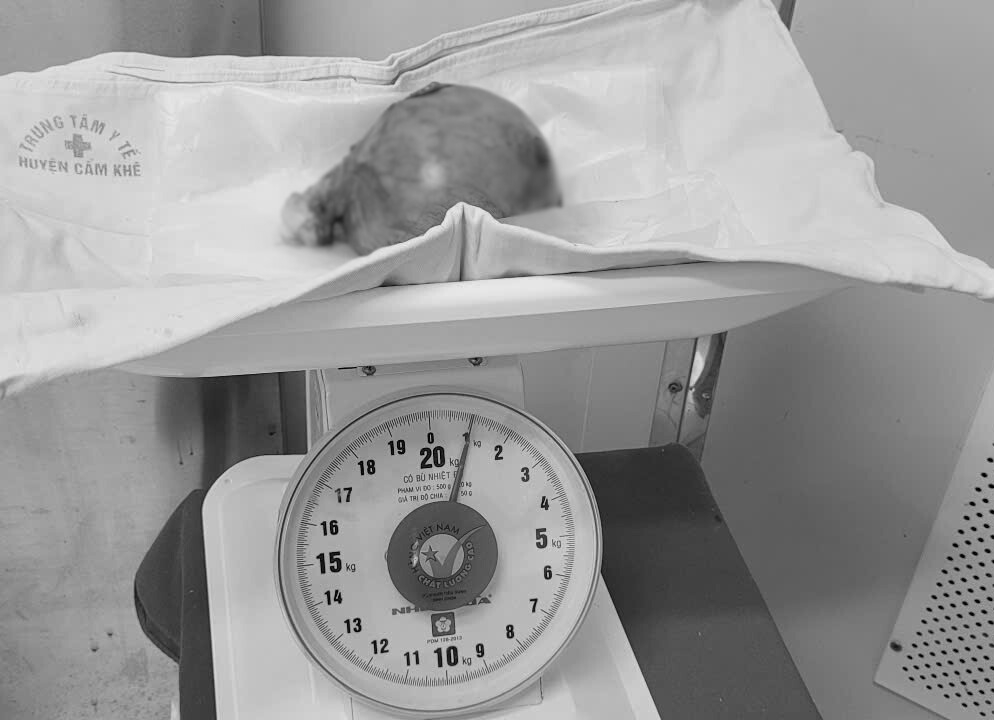 Un fibrome uterin retire chirurgicalement. Photo : BVCC