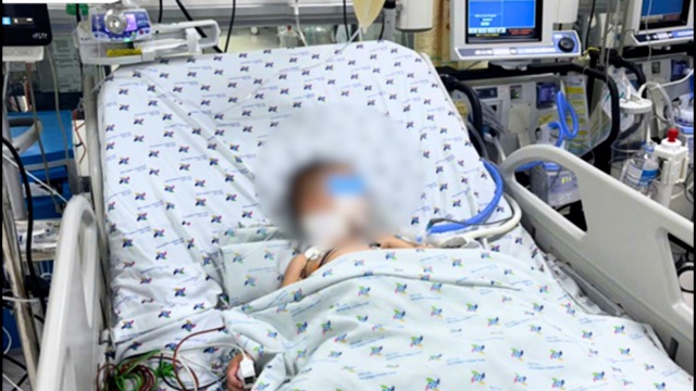 手足口病の小児患者が救命されました。写真:市小児病院