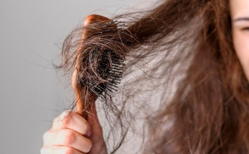 5 Ayurvedic remedies to help reduce hair loss at home. Photo: Thuy Duong