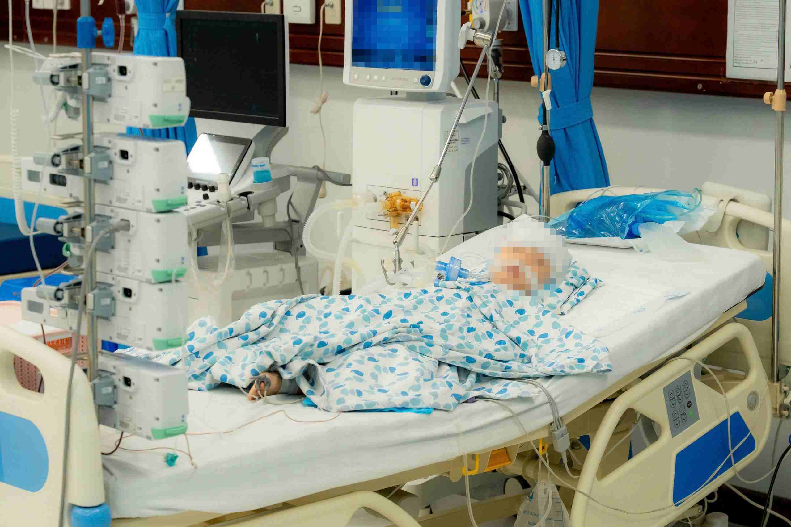 連続交通事故の被害者がハノイ小児病院で救急治療を受けています。写真:BVCC