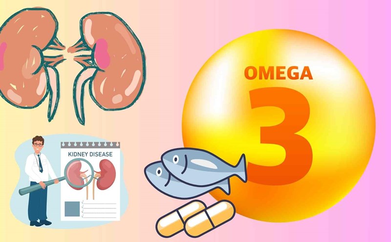 Omega-3 is trusted by many people to support kidney detoxification, but not everyone is good at using it. Some cases should be avoided to avoid causing adverse effects. Graphics: Huyen Trang