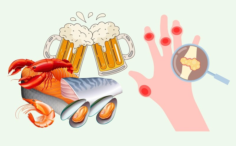 Avoid this dish if you do not want uric acid to be high. Graphics: Linh Dan