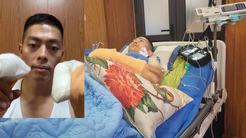 退院直後、Tiktoker Ha Listがギャングに斬りつけられた事件を共有する予定。写真:Lam Thanh