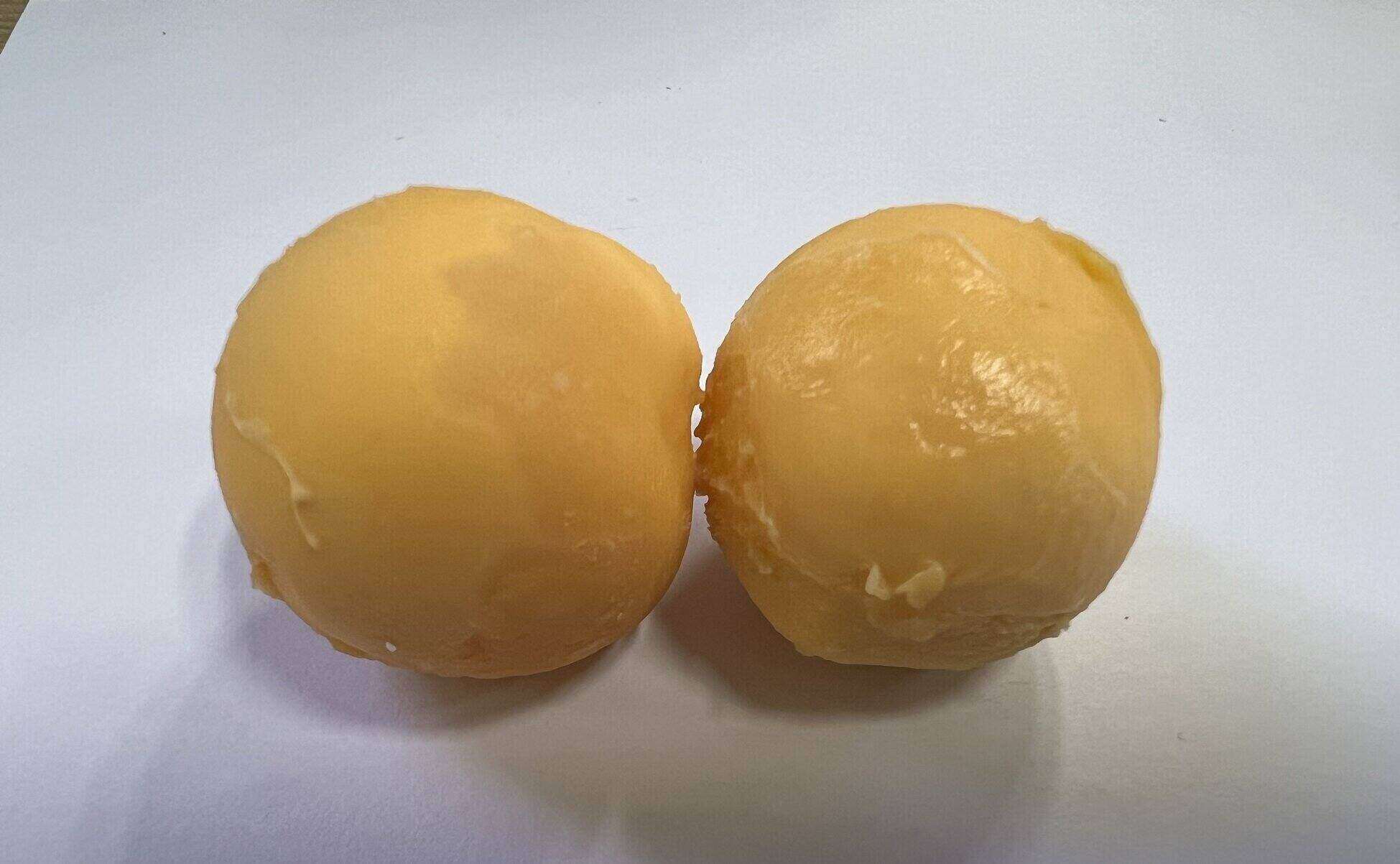 People with high blood pressure need to pay attention to some points when eating egg yolks. Photo: Kieu Vu