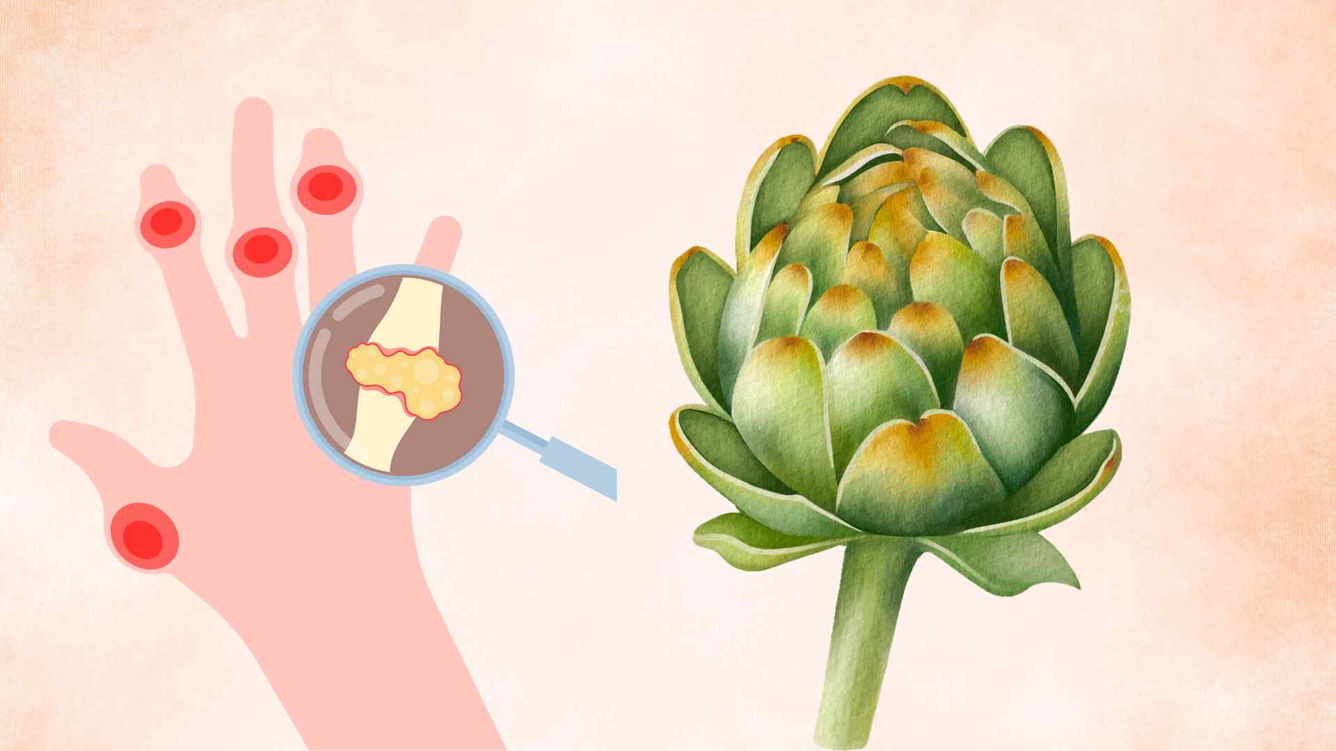 Artichoke has the effect of controlling uric acid levels effectively. Graphic photo: Thai Anh