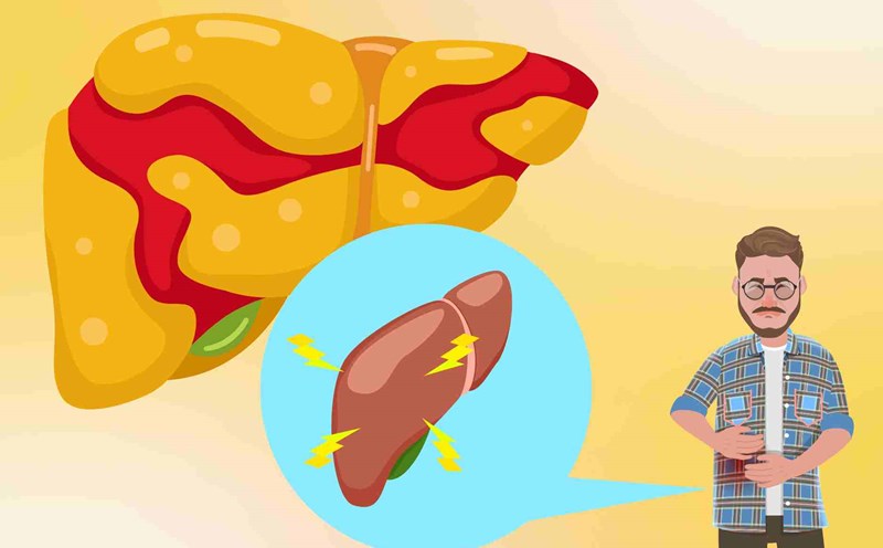 3 signs of fatty liver that easily cause anorexia and bloating