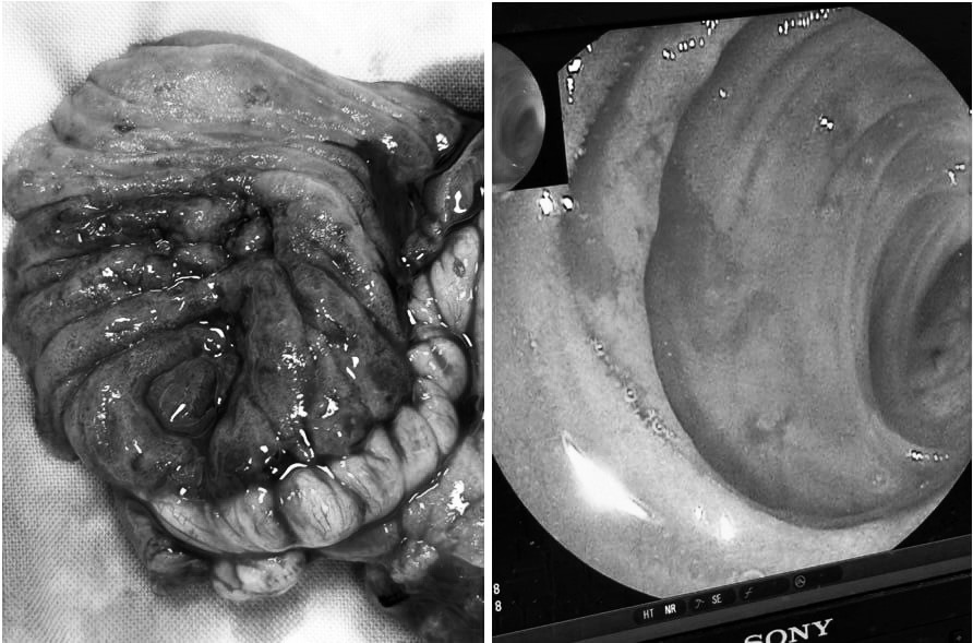 Image of the patient with pre-tertiary bleeding. Photo: People's Hospital 115