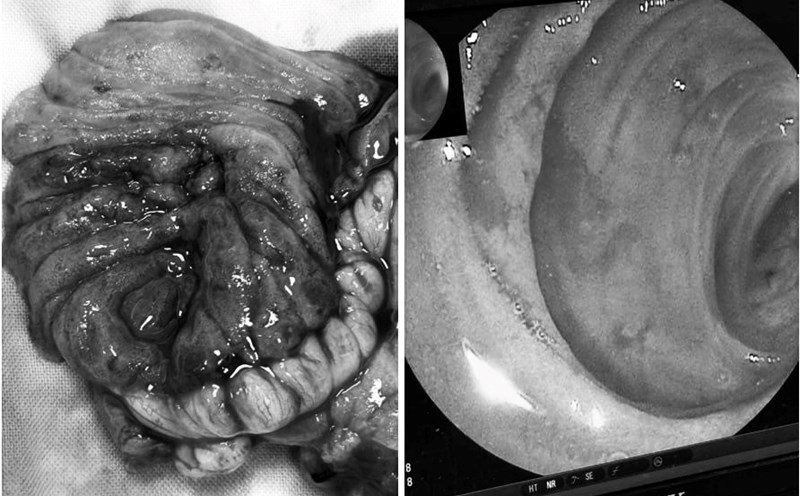Image of the patient with pre-tertiary bleeding. Photo: People's Hospital 115