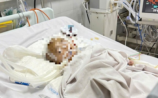 Baby H in Quang Ngai suffered from cerebral hemorrhage when she was sent to a spontaneous nursery group. Quang Ngai Provincial Police have begun investigating. Photo: Vien Nguyen