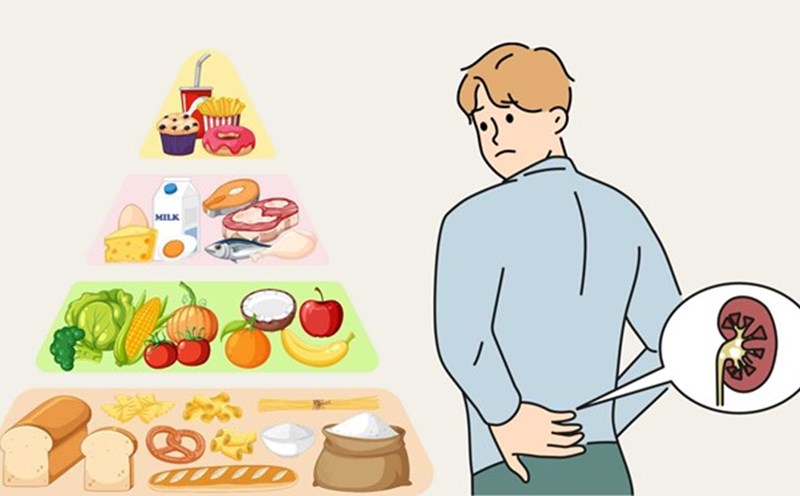 A healthy diet and lifestyle have an impact on chronic kidney disease. Graphics: Ha May