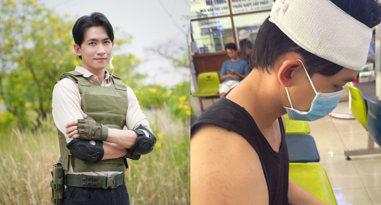Võ Cảnh gặp chấn thương khi quay phim Cô đừng hòng thoát khỏi tôi