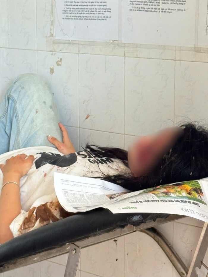 5 sinh vien bi thuong nhe, da duoc cuu chua kip thoi. Anh: Lam Hong