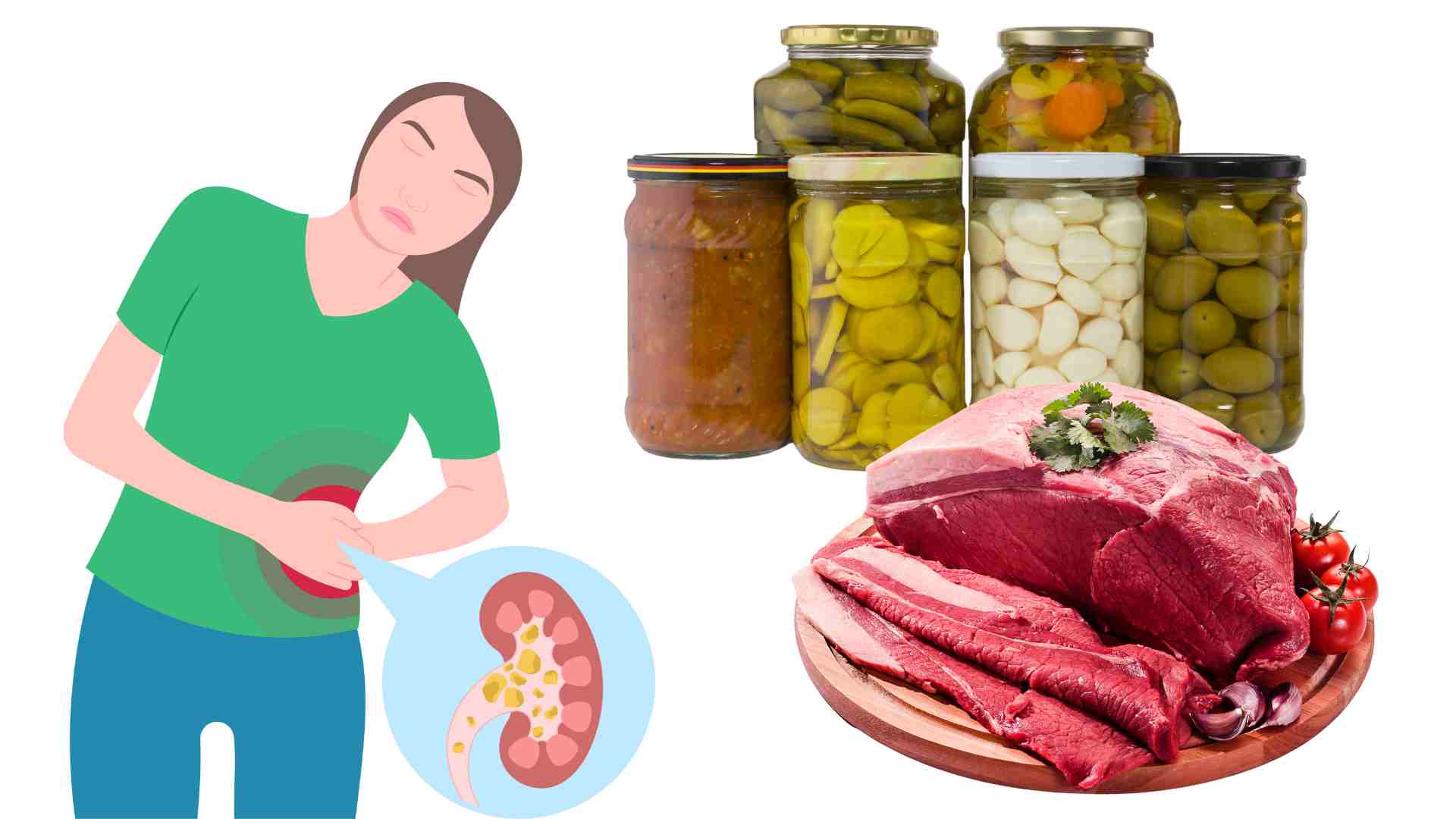 Some dishes can increase the rate of kidney failure. Graphics: Ha May