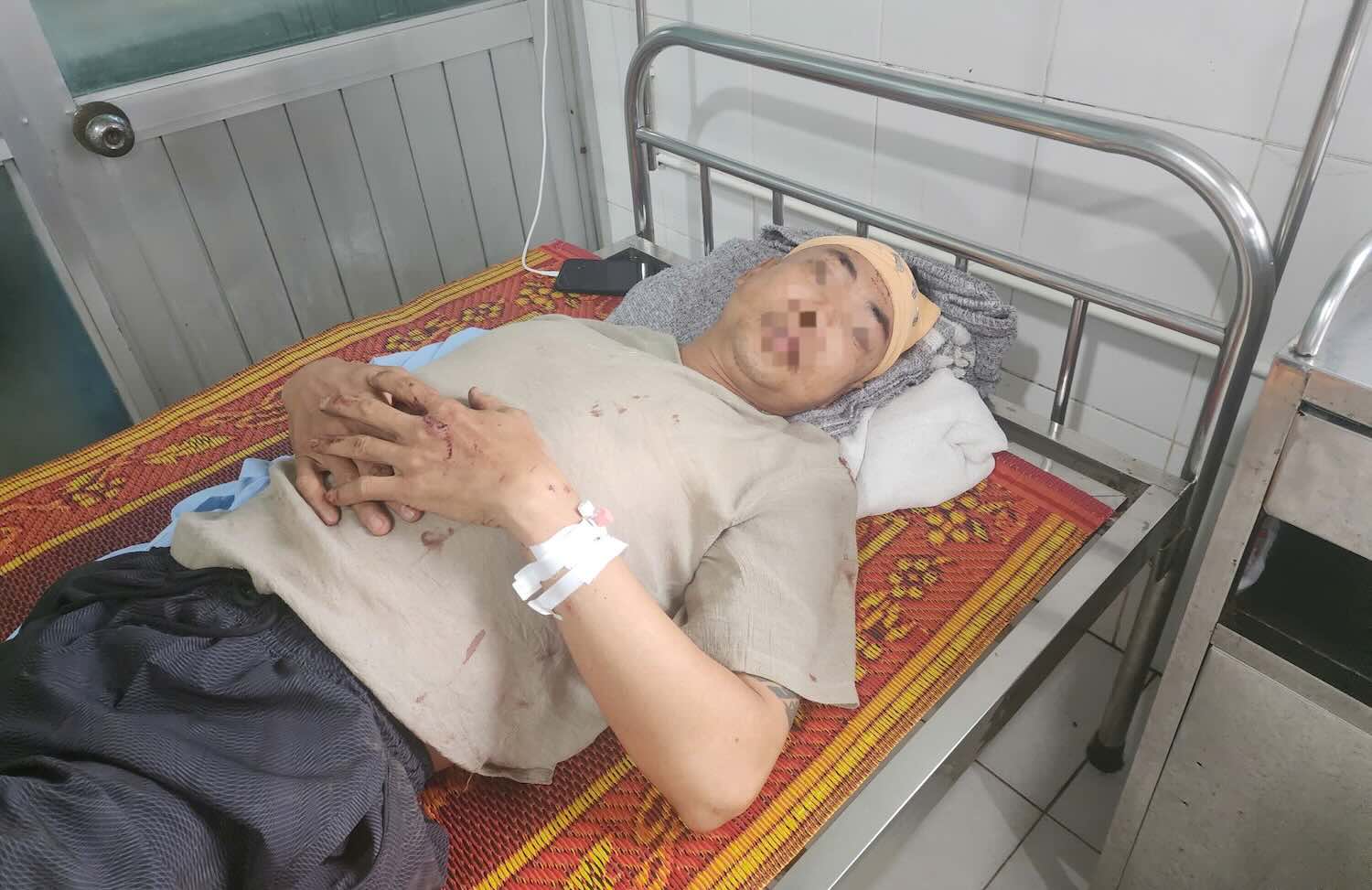 사고를 당한 승객 Nguyen Quang Trang 씨가 버스 사고 당시 상황을 이야기하고 있습니다. 사진: Vu Tuan