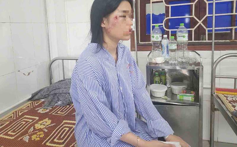 Many injured victims of the passenger bus overturn in Ha Tinh have been discharged from the hospital. Photo: Tran Tuan.