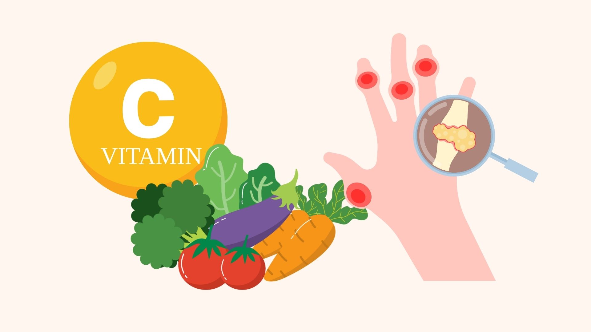 집에서 요산 수치를 낮추는 매우 쉬운 방법. 그래픽: 린단