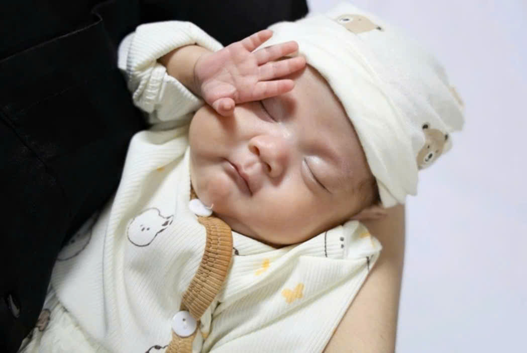 The girl born prematurely in week 24, weighing only 550 g in Phu Tho, survived spectacularly. Photo: BVCC