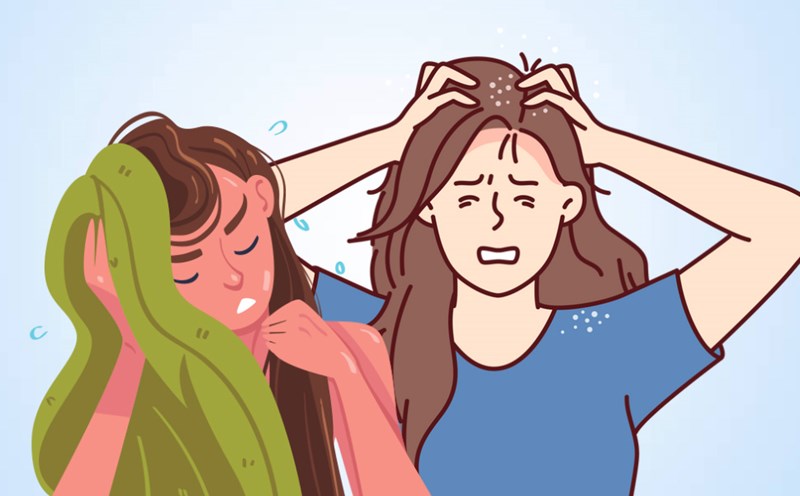 Sleeping with your hair still wet is a habit that can easily cause dandruff and acne. Graphics: Thien Nhan