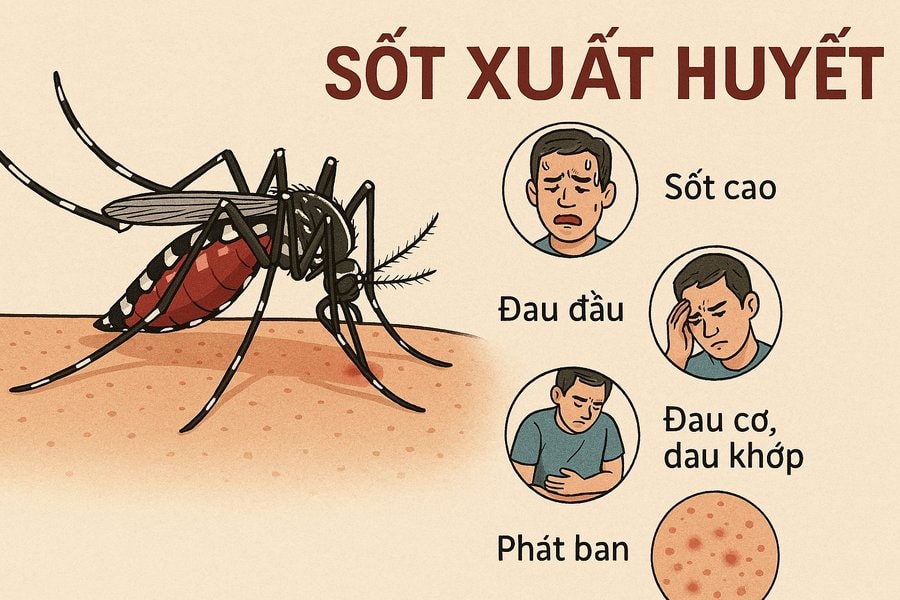 Warning of dengue fever peak. Graphics: Huong Giang
