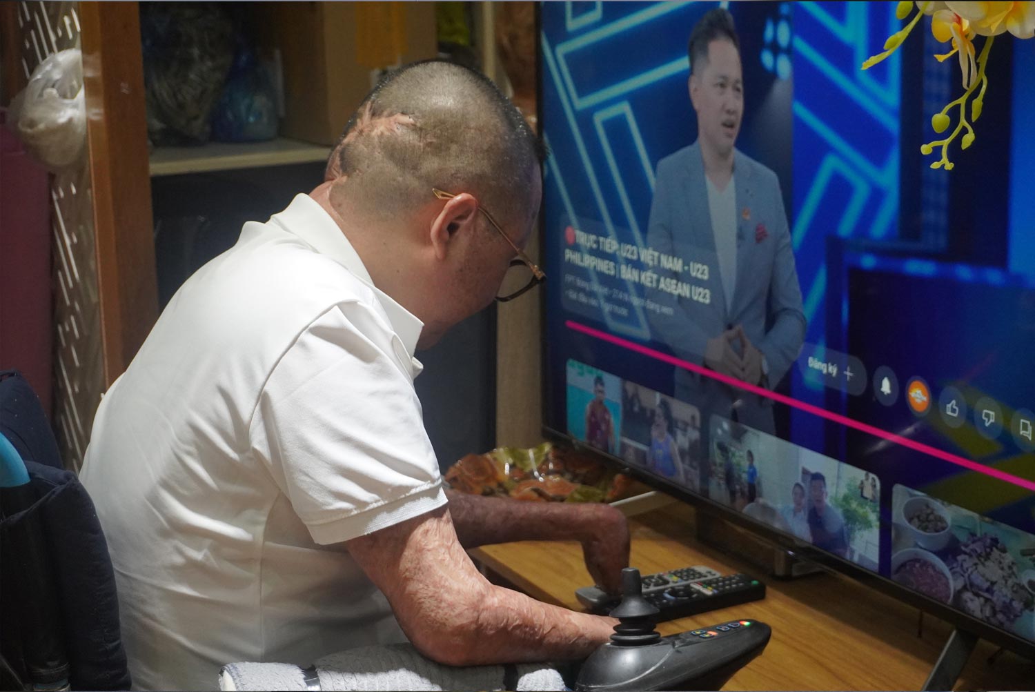 Du da mat doi ban tay nhung anh Duong van co gang khac phuc kiem khuyet cua minh, van co the tu minh mo tivi, dung dien thoai, bat quat... Anh: Hoang Xuyen