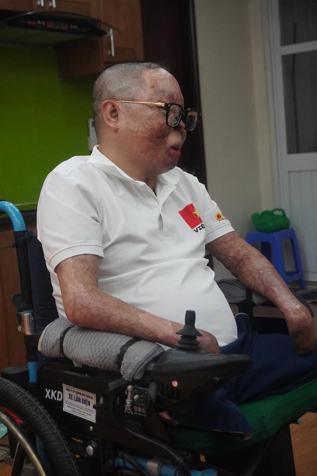 Nhung ky uc ve ngay 7.7.2014 van con ven nguyen trong tam tri cua nguoi linh dac cong Dinh Van Duong. Anh: Hoang Xuyen