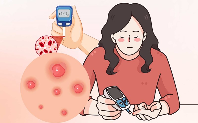 Early recognition of diabetes with 3 signs on the face