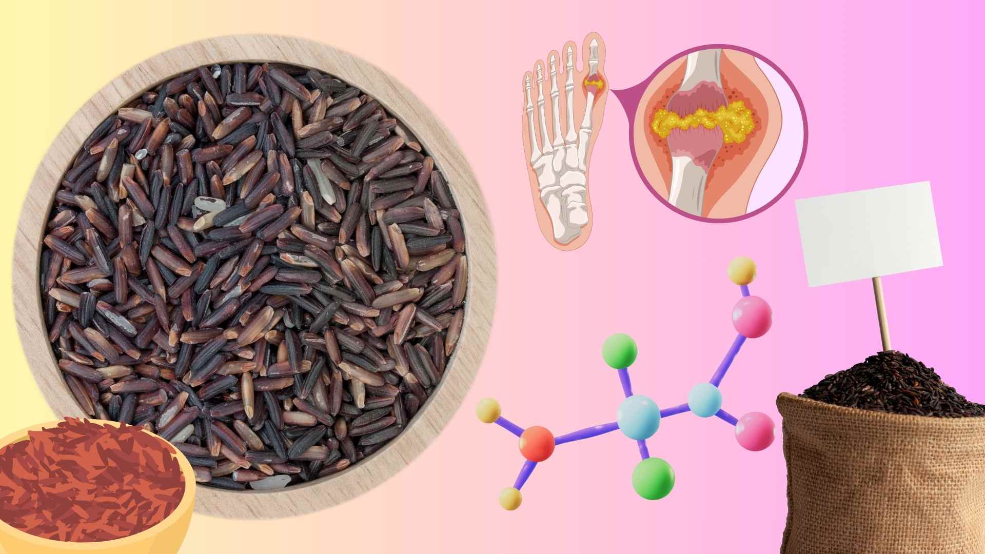 How much brown rice should you eat each day to effectively control uric acid? Graphics: Huyen Trang