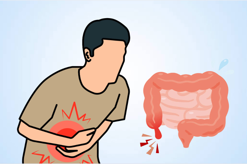 Excess gut inflammation in children can cause dangerous complications if not detected and treated promptly. Graphics: Thien Nhan