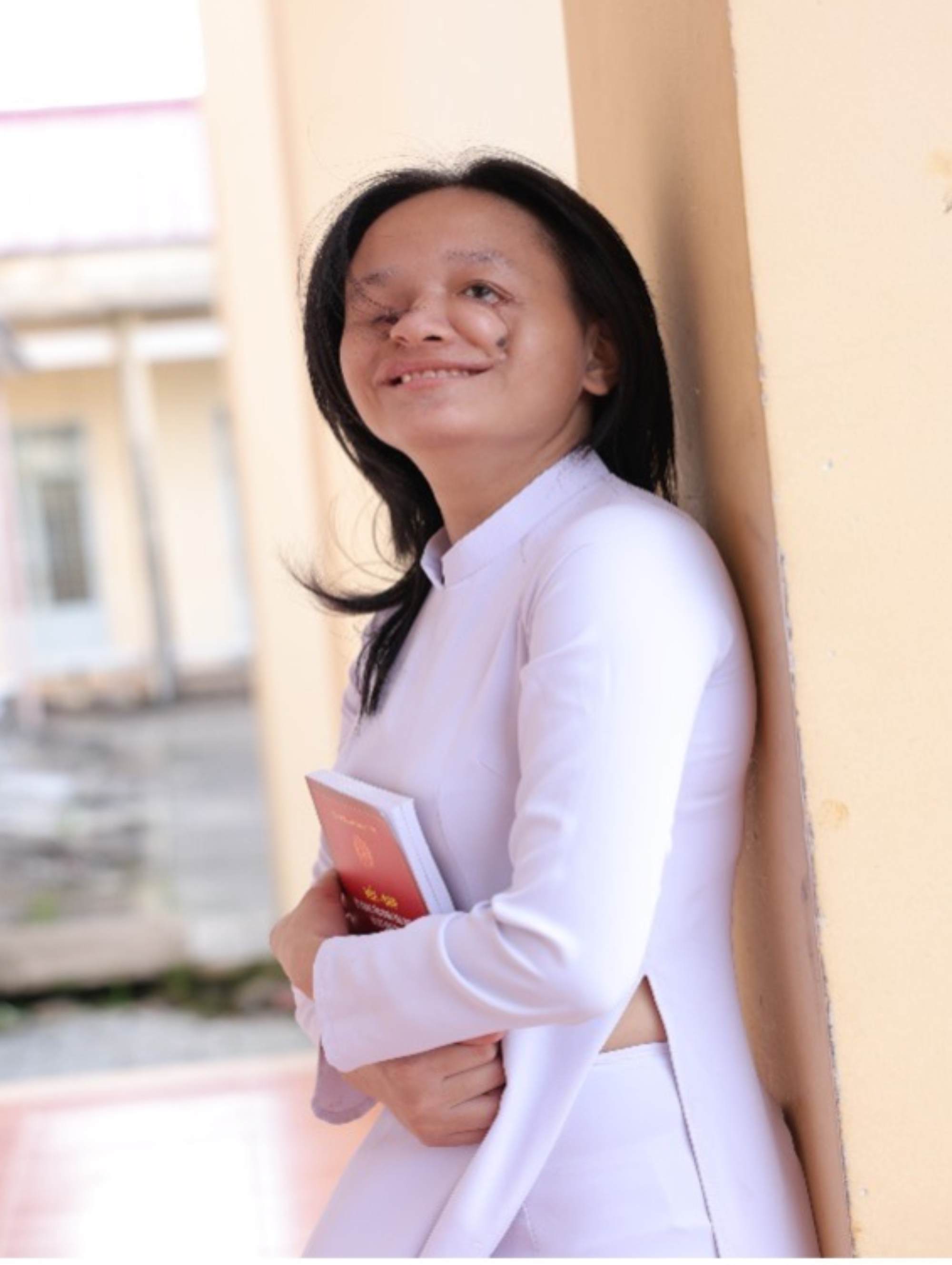 Du co nhung khiem khuyet tren guong mat, Ngoc Huyen van lac quan va dat thanh tich hoc sinh gioi. Anh: Nha truong cung cap