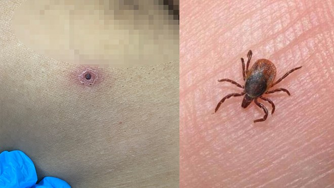 Image of the patient's operation wound caused by enteritis. Photo: BVCC