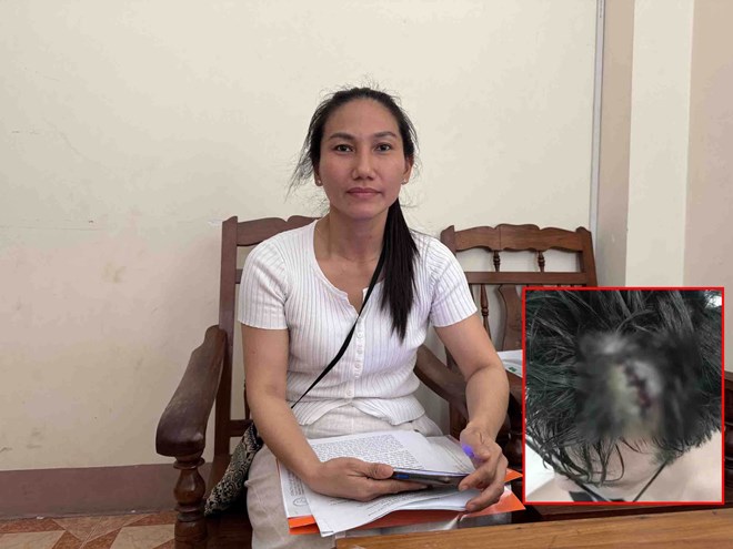 Bà Phạm Thị Minh Chánh kêu cứu vì con bị 3 nam sinh đánh hội đồng toác đầu ở Nha Trang. Ảnh: Hữu Long
