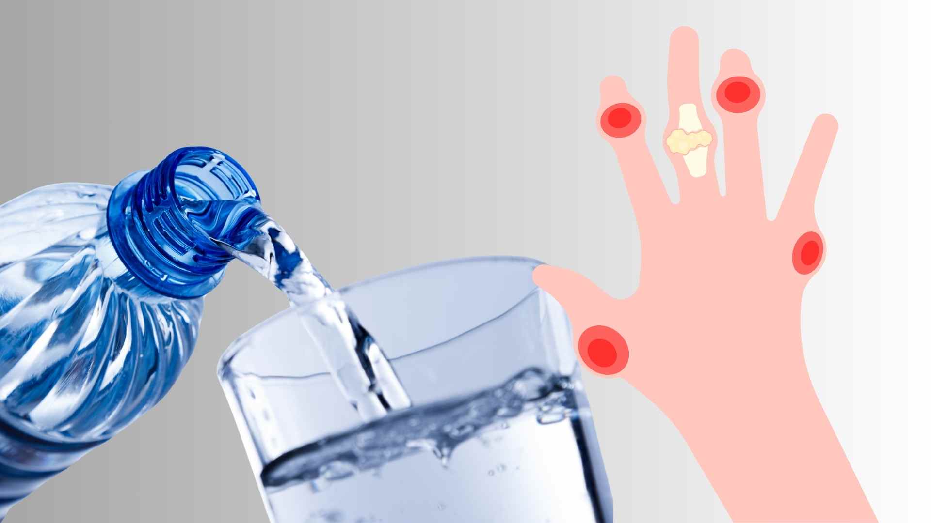 Drinking enough water helps prevent gout. Graphics: Ha May