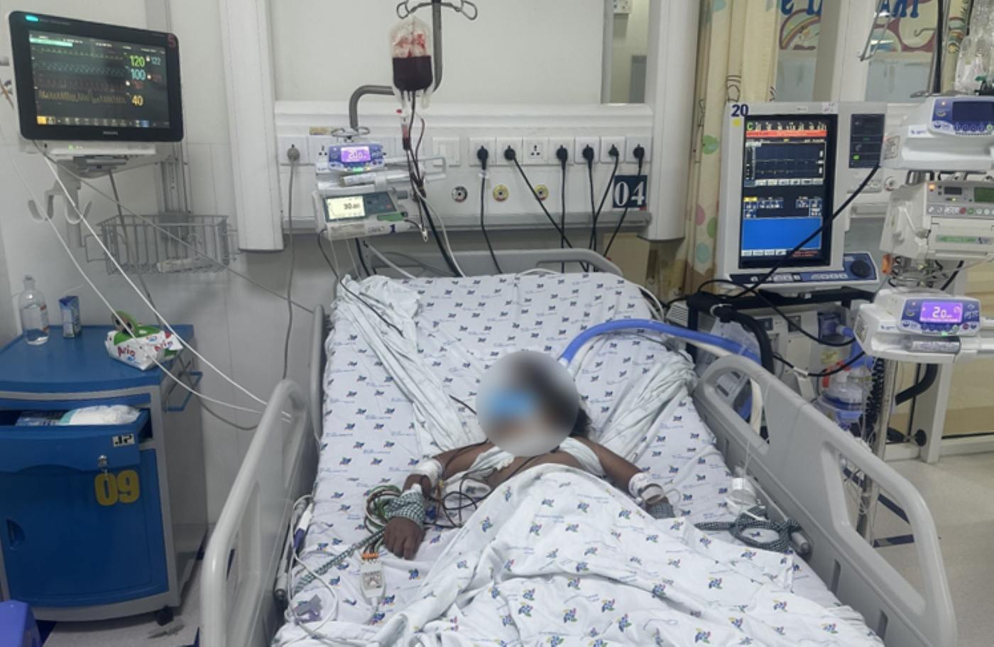 Children hospitalized for severe dengue shock. Photo: Provided by the hospital