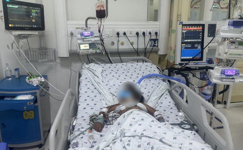 Children hospitalized for severe dengue shock. Photo: Provided by the hospital