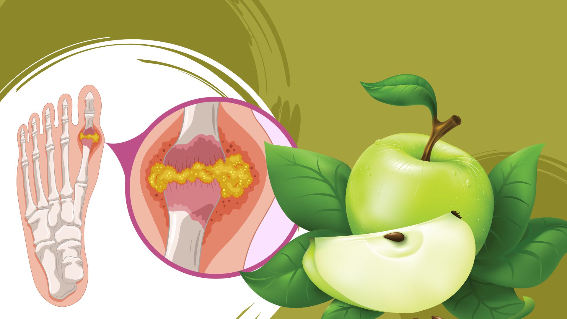 Apple is a fruit that supports high uric acid. Graphic photo: Huong Son