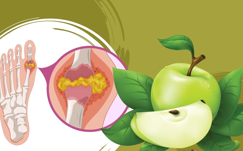 Apple is a fruit that supports high uric acid. Graphic photo: Huong Son