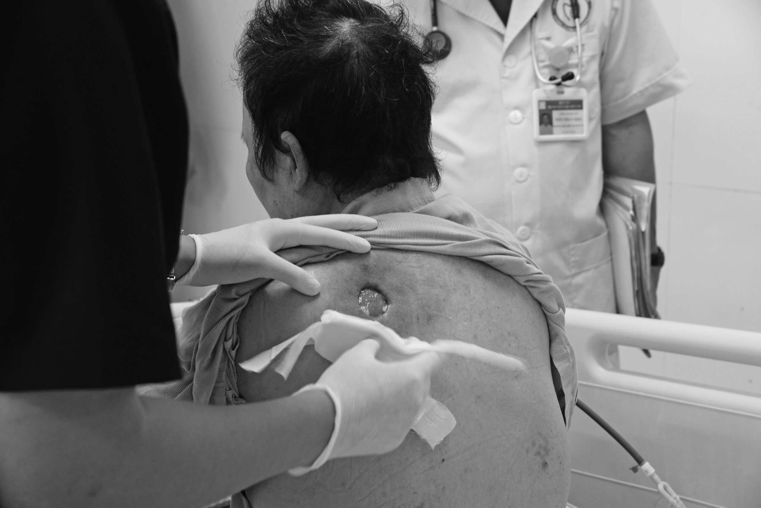 The patient has critical diabetes, complications from drinking detox sugar water according to the traditional healer. Photo: BVCC