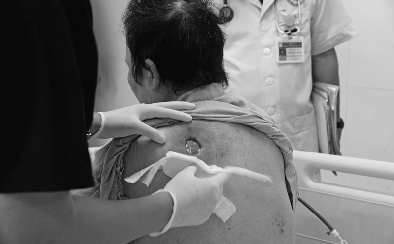 The patient has critical diabetes, complications from drinking detox sugar water according to the traditional healer. Photo: BVCC