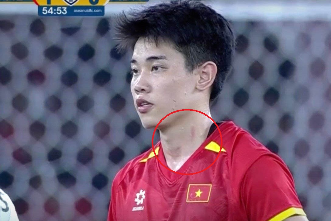The scratch on Dinh Bac's neck in the 2025 U23 Southeast Asian Cup final. Photo: Cut from video
